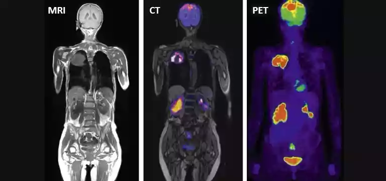 Decoding Diagnostic Imaging: Differences between MRI, PET, and CT